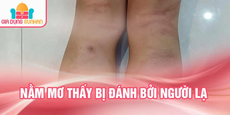 Nằm Mơ Thấy Bị Đánh: Bí Ẩn Tâm Linh Chưa Biết Đến 2 Nằm mơ thấy bị đánh bởi người lạ
