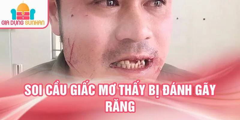 Nằm Mơ Thấy Bị Đánh: Bí Ẩn Tâm Linh Chưa Biết Đến 3 Soi cầu giấc mơ thấy bị đánh gãy răng